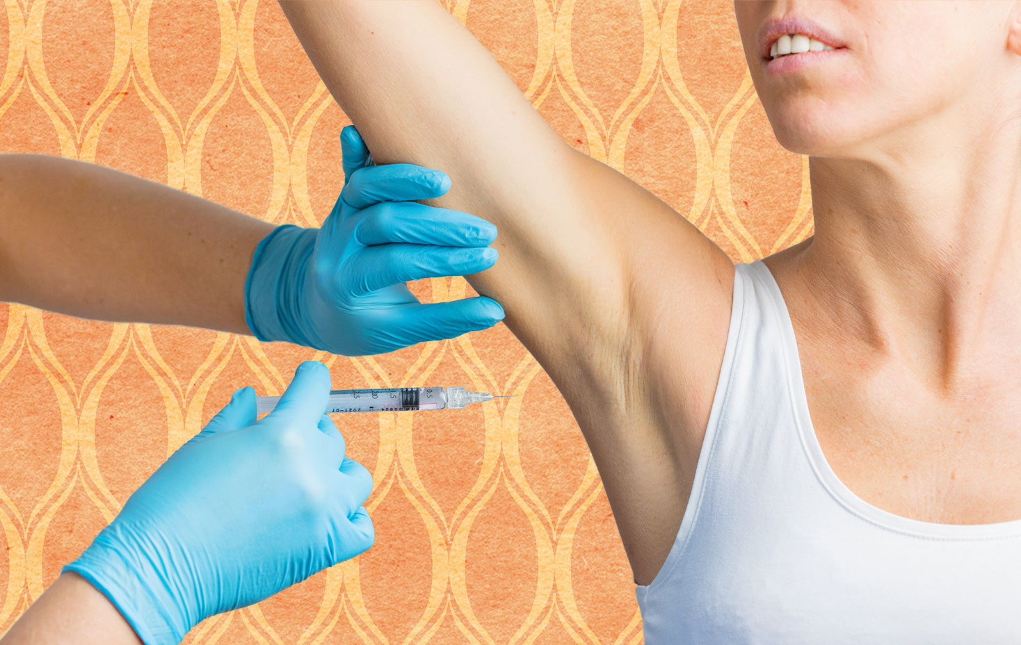 BOTOX® Underarm Sweat Reduction at Hello Laser Spa